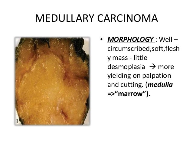 describe pathology of the breast Describe pathology of the breast